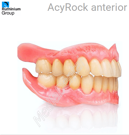 AcryRock anterior