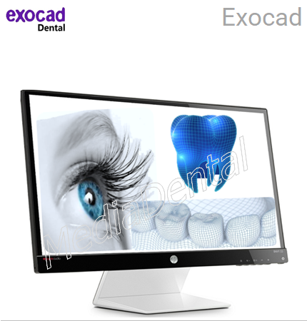 Exocad